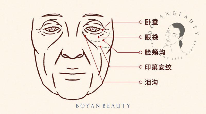 博妍医美 关于印第安纹_颧骨