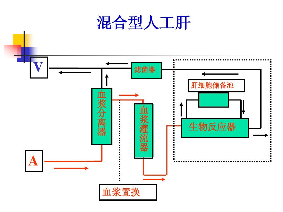 人工肝是什么