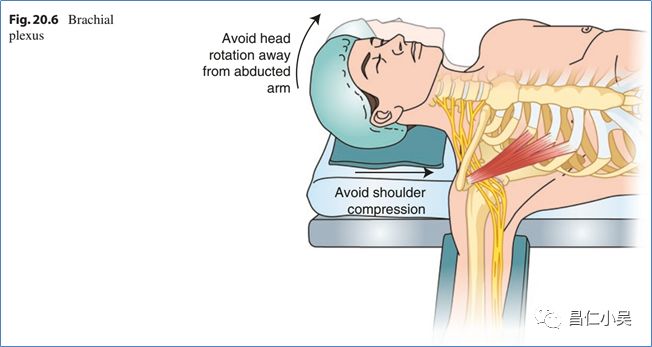 神经解剖学习笔记神外手术的体位