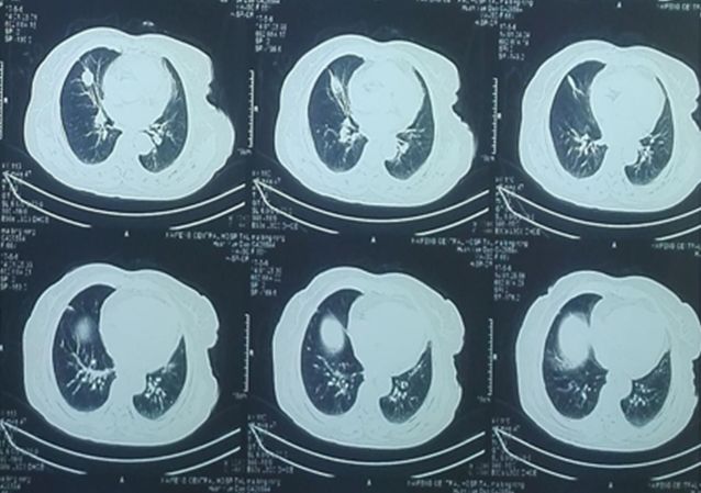 科普显微镜下的火眼金睛