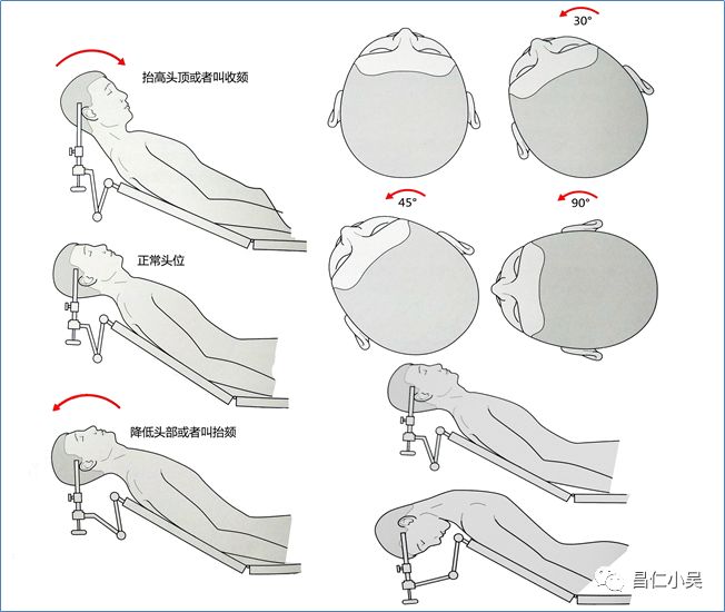 神經解剖學習筆記神外手術的體位