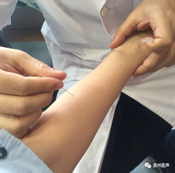 根据正骨医院微针科学科带头人林思雄主任介绍,微针治疗是微针科在