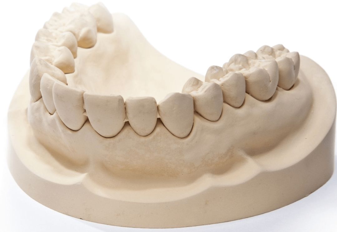 首先需要制作一副你牙齿的石膏牙模,就像牙防所里的那种牙磨,只要闭上