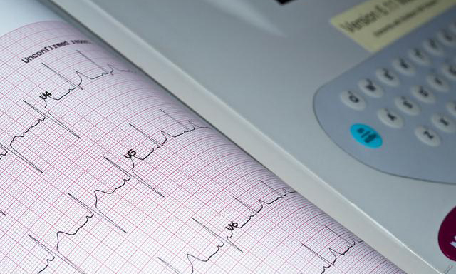 心电图心率140次/分,为什么医生说有可能是正常的?