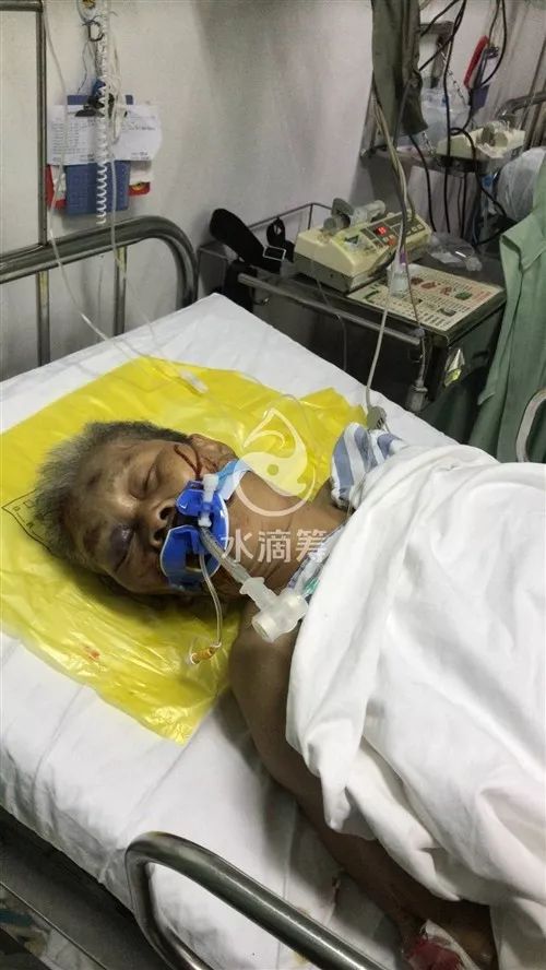 揪心無兒無女瓊海77歲孤寡老人橫遭車禍重傷住院