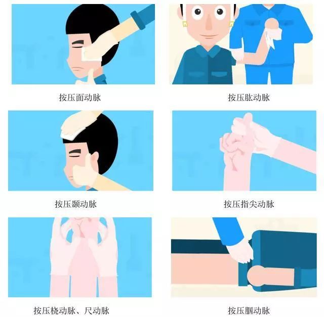 指压止血法——若动脉出血,直接按压伤口,同时采取压迫动脉近心端止血