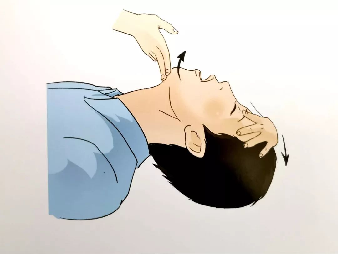 人工呼吸开放气道,用按于前额手的食指和拇指捏紧患者鼻孔.