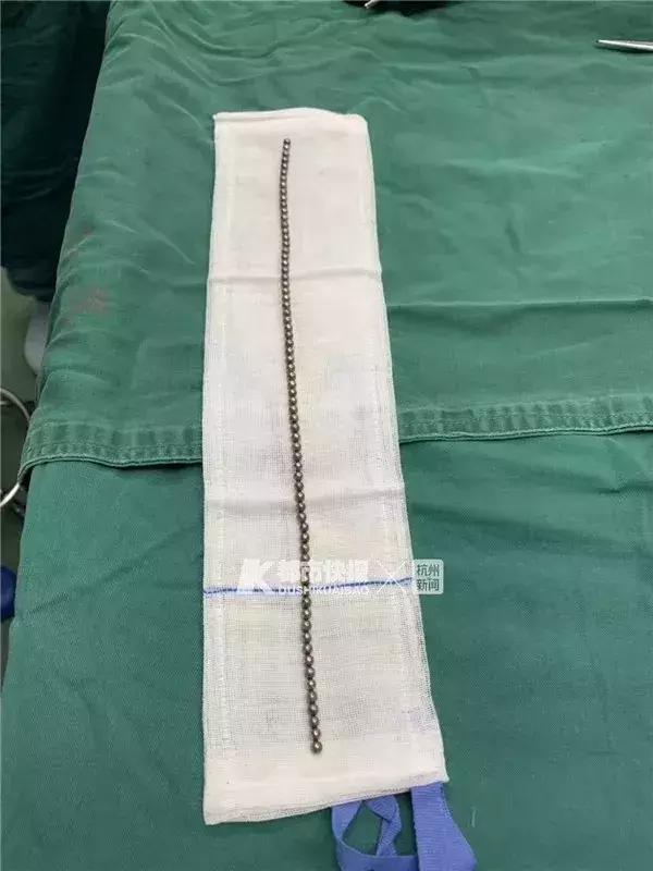 别什么东西都往肛门塞真的会出事医生要给你提个醒