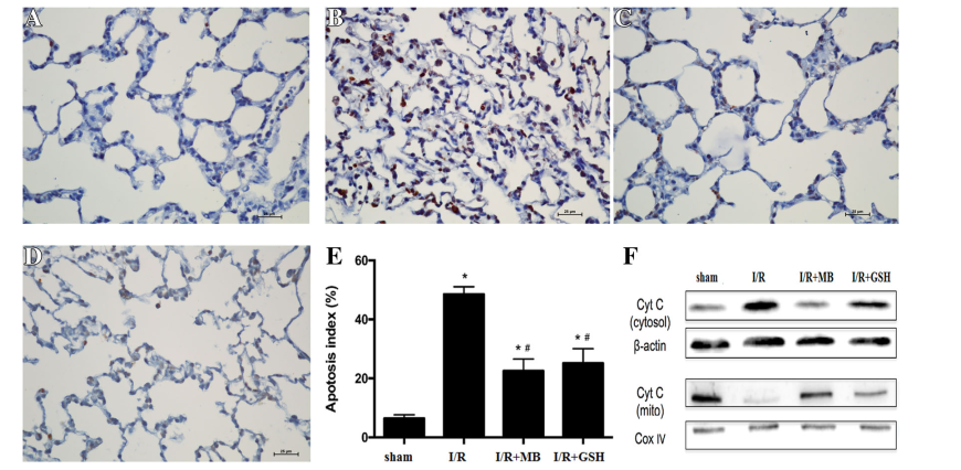 来源:methylene blue protects the isolated rat lungs from