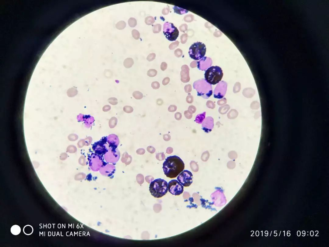 火眼金睛识细胞协助临床定诊断