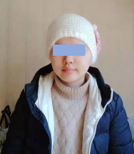 正海妙术视界丨楼美清教授内镜经鼻斜坡切除侵犯脑干的肿瘤