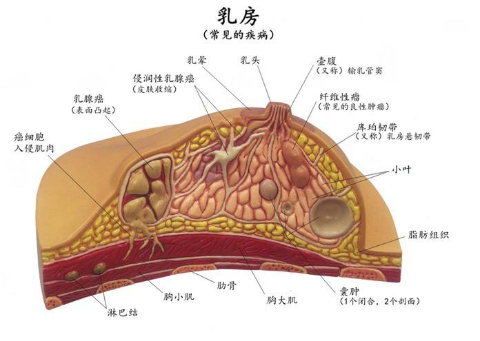 乳房由脂肪层,腺体层共同构成,腺体由乳腺小叶及乳导管组成