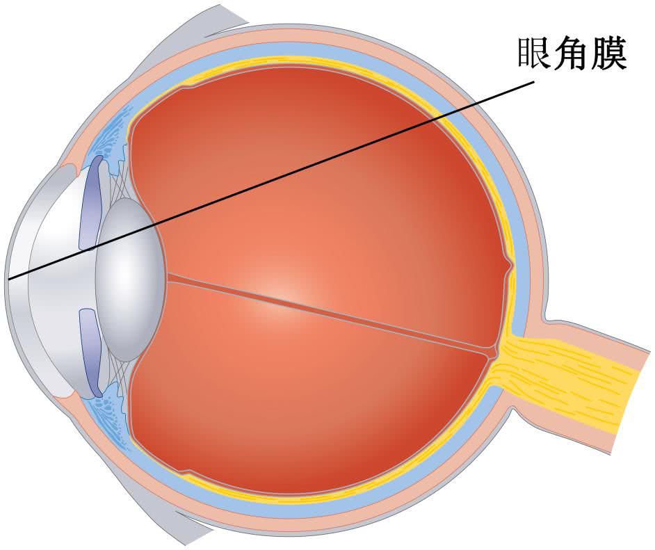 不把眼表疾病当回事小心发展成角膜盲