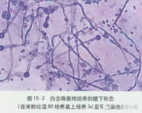 白假丝酵母菌镜下图图片