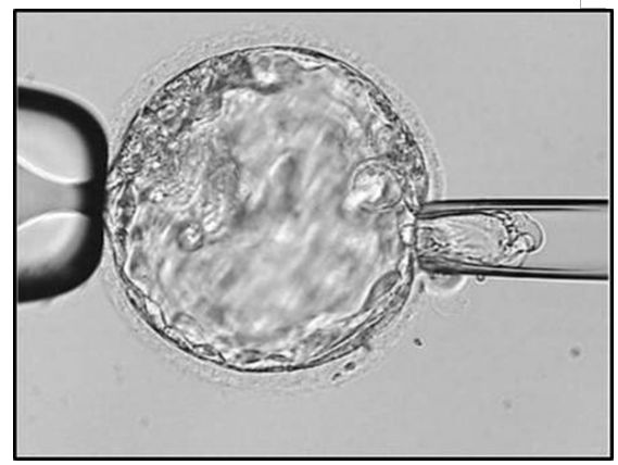 囊胚比起冻胚更有移植优势吗