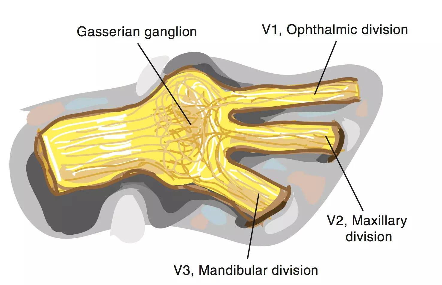 三叉神经痛 (转载)