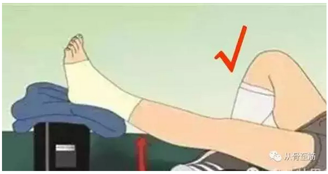 石膏固定后患者必须注意事项! (转载)