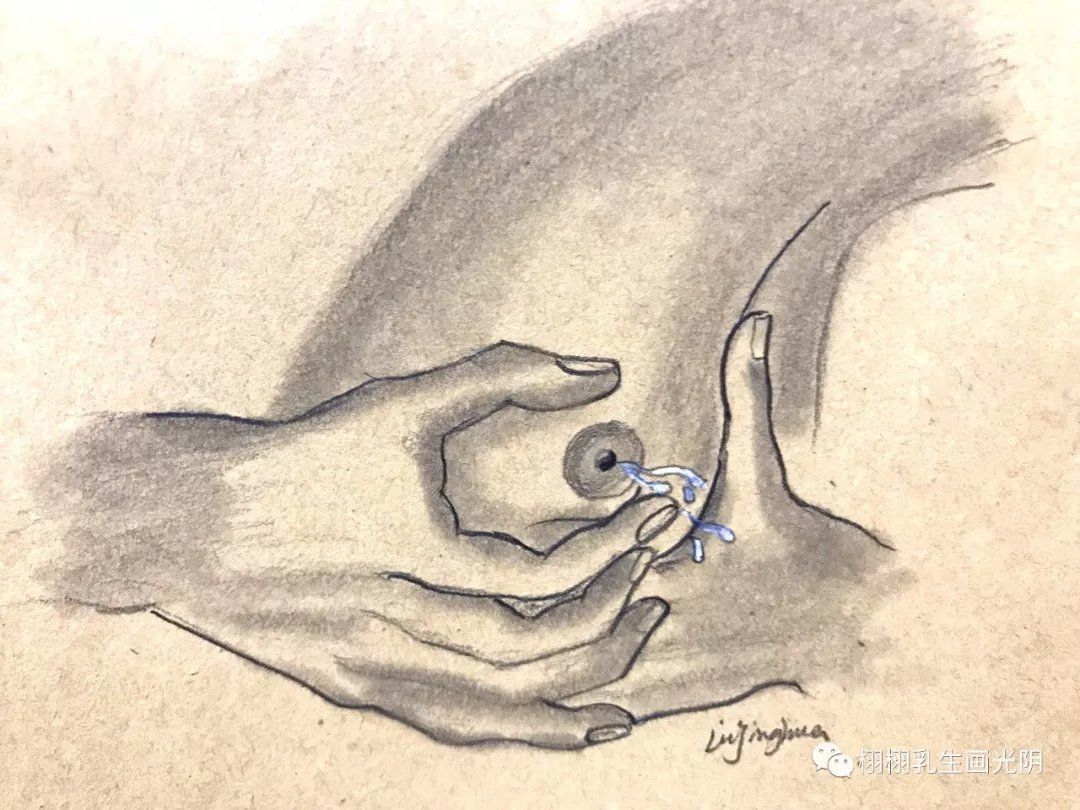 乳头溢液-小毛病,大麻烦 (原创)_治疗