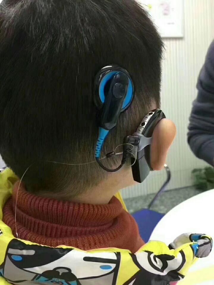 儿童助听器佩戴效果图图片