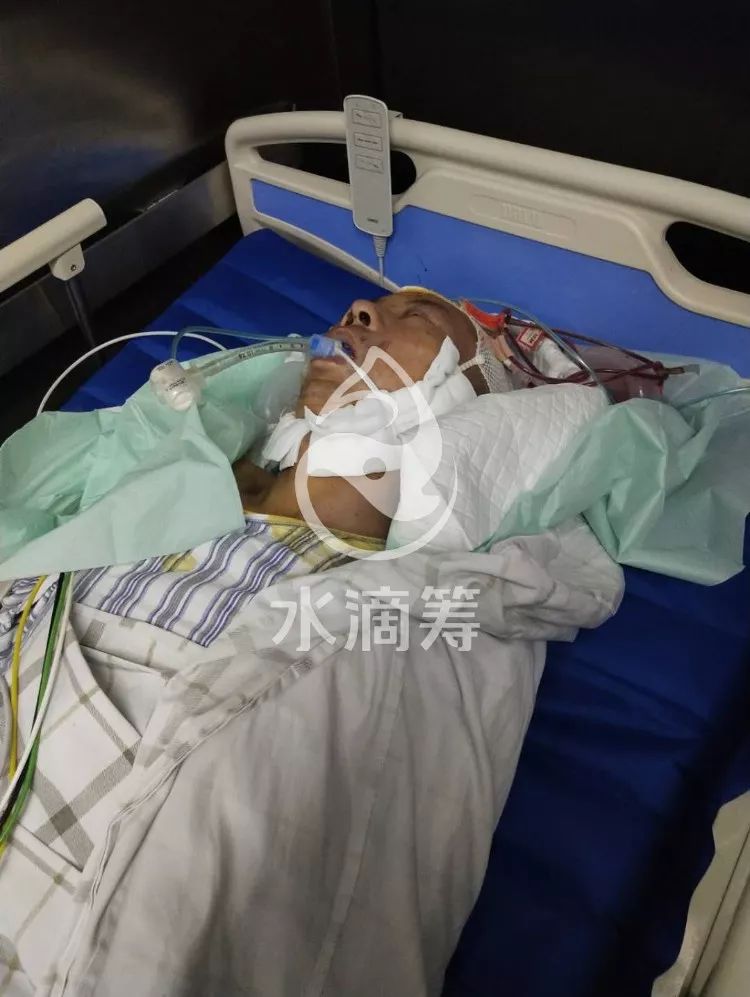 高坠摔伤两天三次开颅手术至今昏迷!急需您的帮助