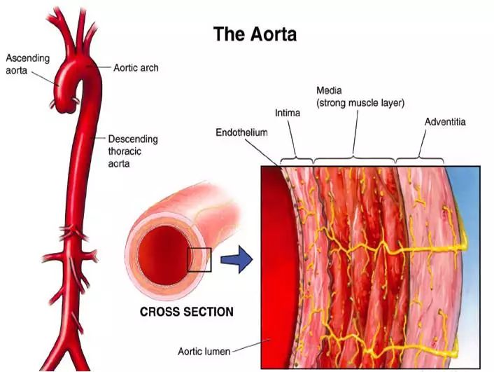 腹主动脉瘤破裂vs主动脉夹层与心梗之间de鉴别转载