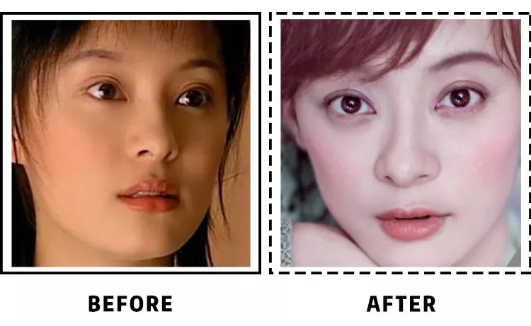 在整形项目中,开眼角算是非常小的手术了,圈内很多明星都做过.