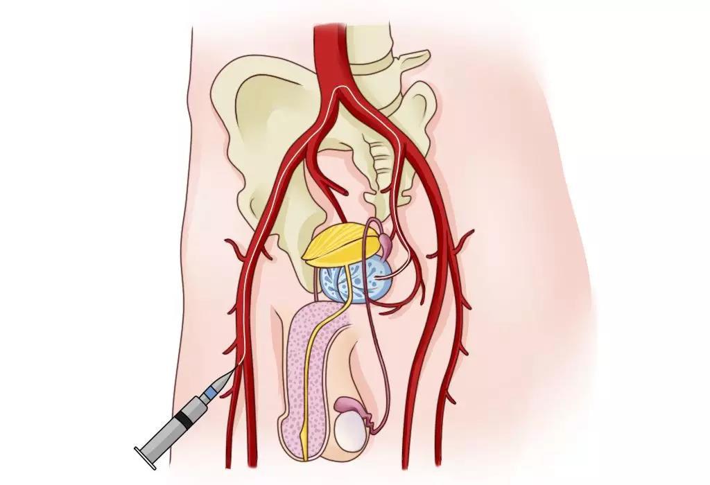 建议超过40岁的男性都看看_前列腺