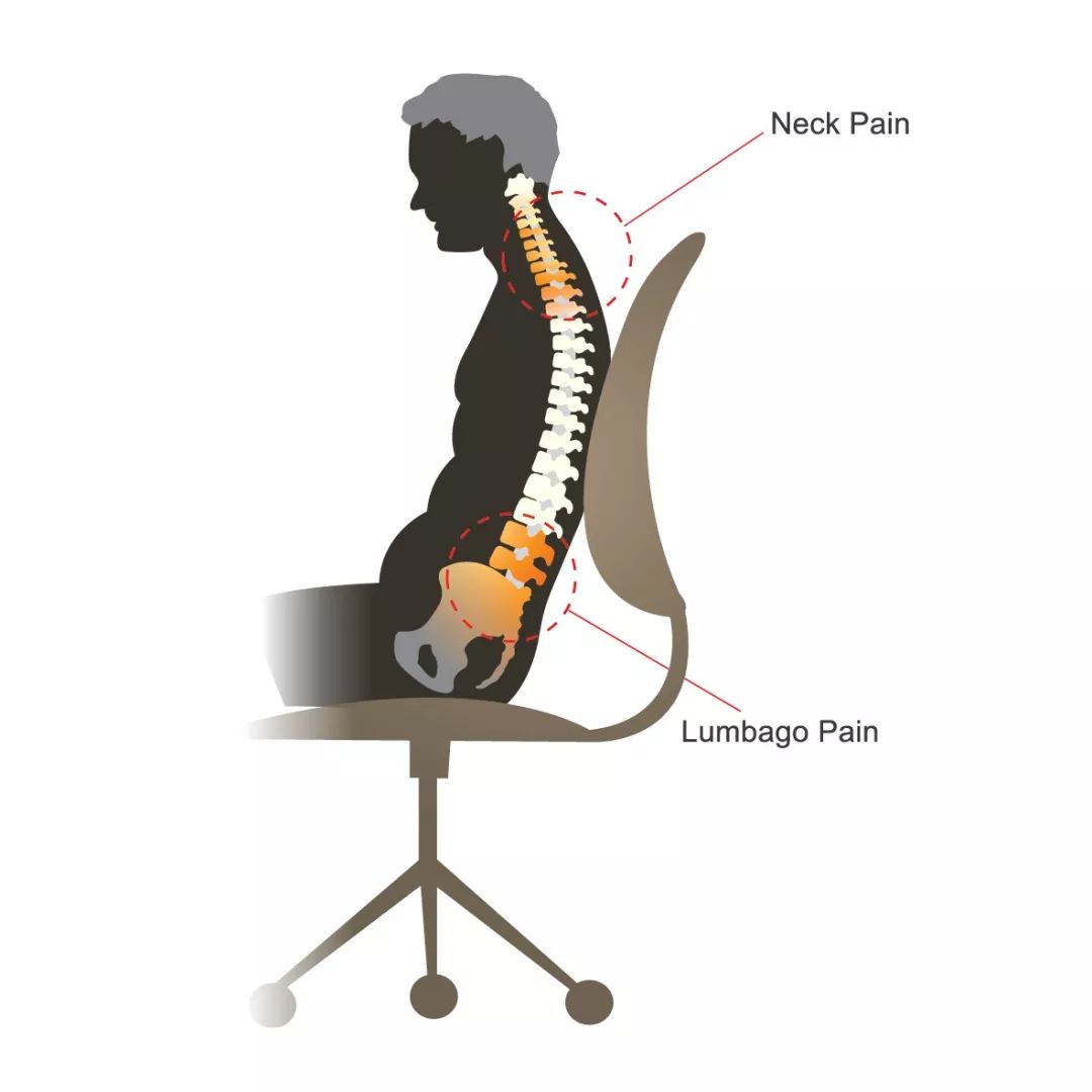 【关注】久坐族,当心腰椎间盘突出症来袭