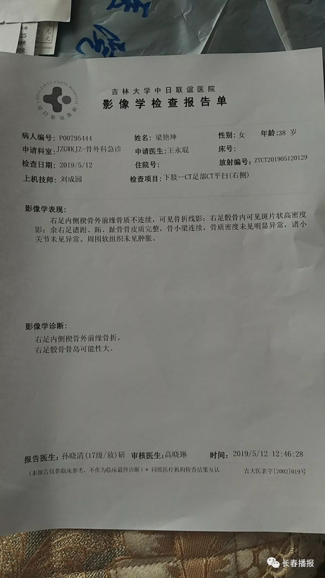 脚崴了ct诊断报告图片图片