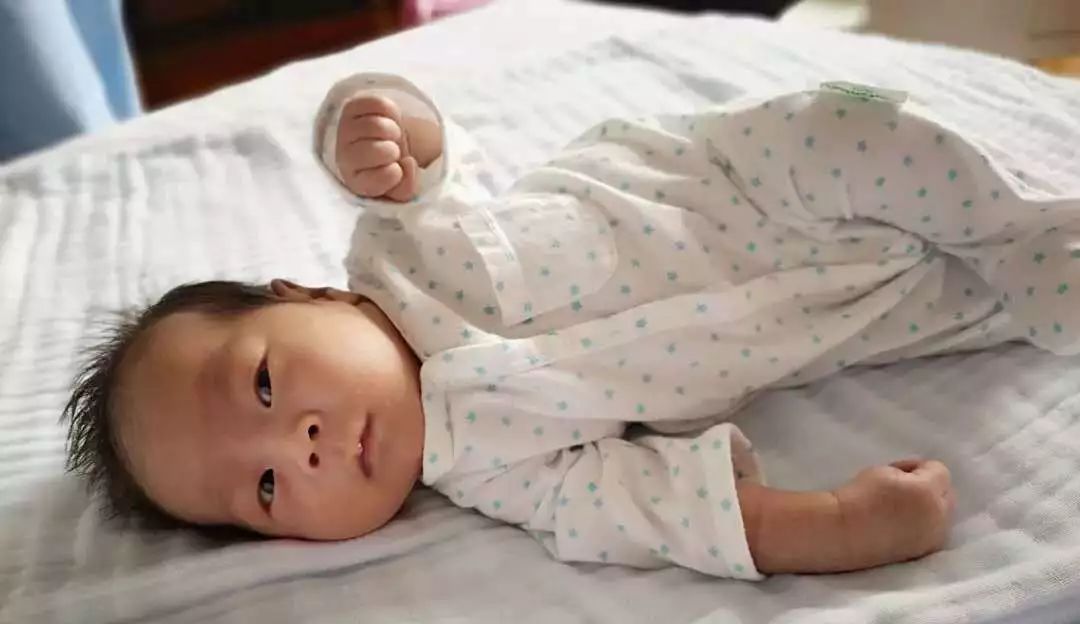 巨人症早逝魔咒第三代试管婴儿从源头阻断单基因罕见病马凡综合征