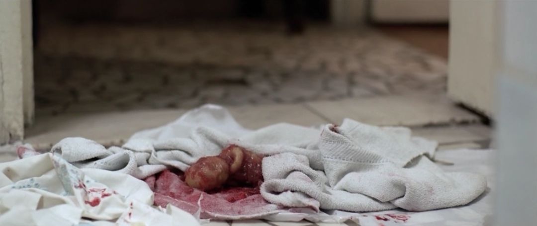 已种草网上卖打胎药米菲米索的商家3次意外的打胎经验