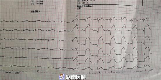 88岁老人突发急性心梗濒临死亡医生21分钟开通血管救心