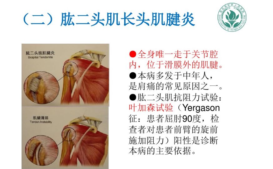 肩關節軟組織壓痛點的解剖與臨床二