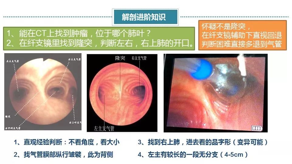 準確判斷左右主支氣管及右肺上葉開口;能夠準確將大體解剖,纖支鏡下