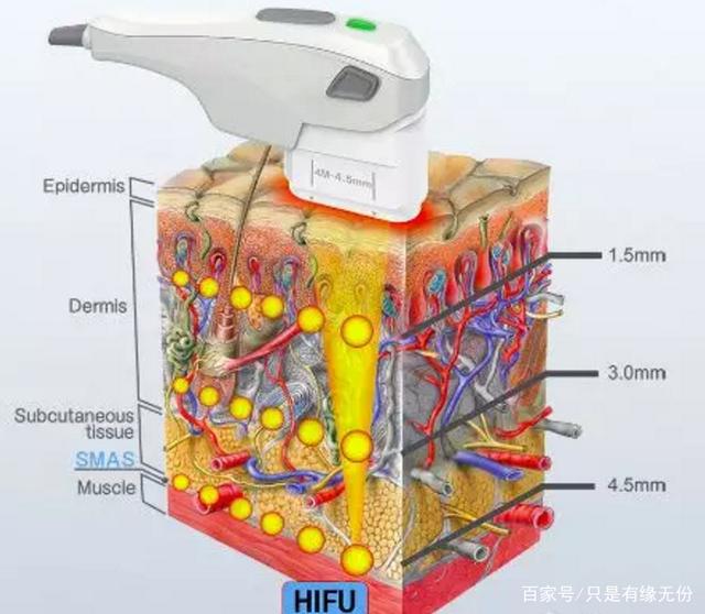 面部超声刀多久做一次?90%的人都不知道的秘密?