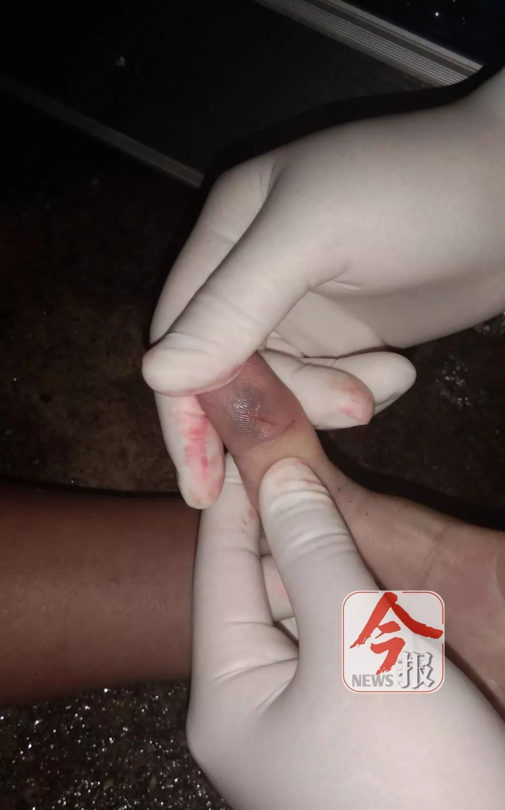 广西多地蛇出没甚至有人因此而丧生这份防范和自救手册快收好