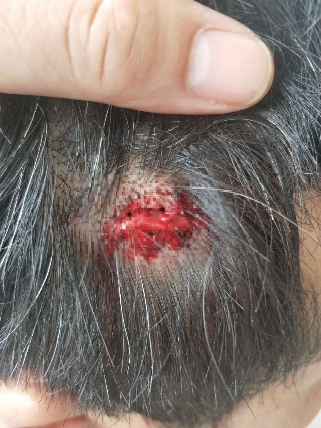 河南桐柏城管暴力执法将受害者带至偏僻处毒打受伤的却是自己