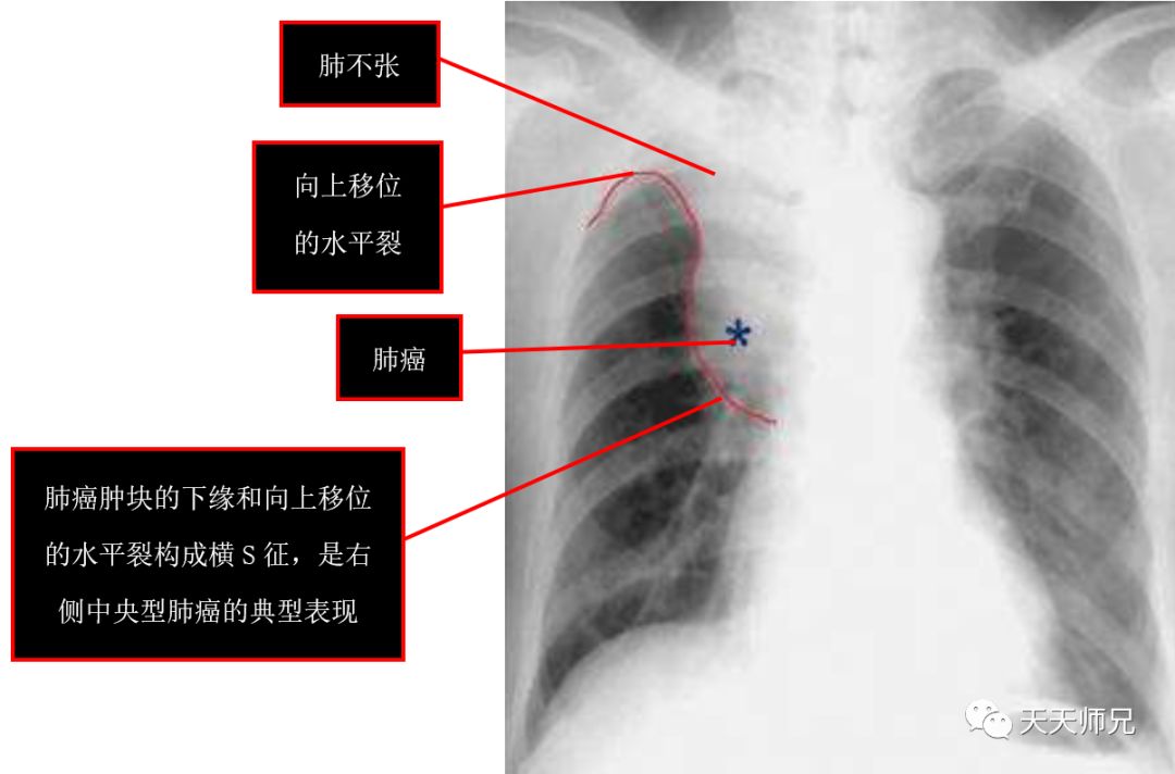 執業醫師第三站真題上篇