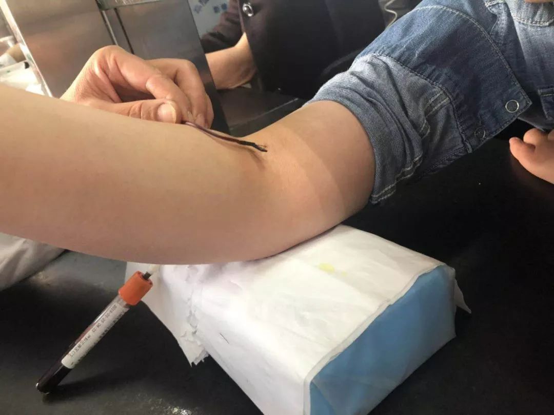 肘部静脉看不见这里有招快来看