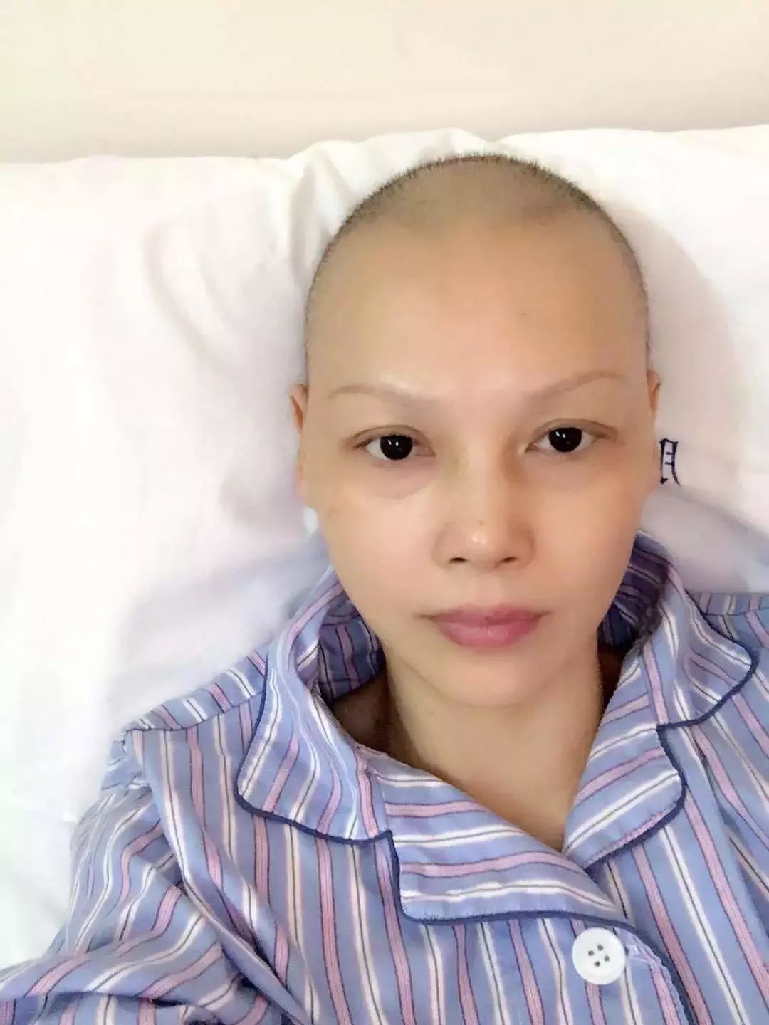 癌症算什么她的生活里都是歌