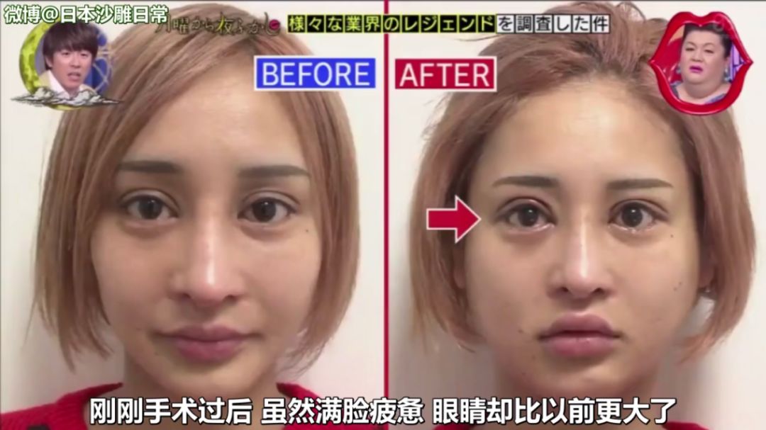 从石原里美整成桥本环奈是种啥体验