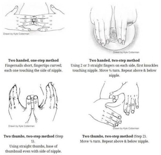 乳晕水肿—反向按压软化法 (原创)_手指