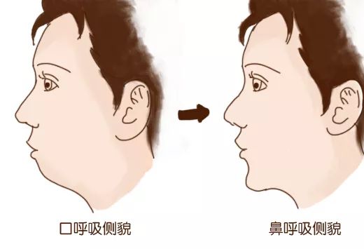 妈妈们这些要知道._牙齿