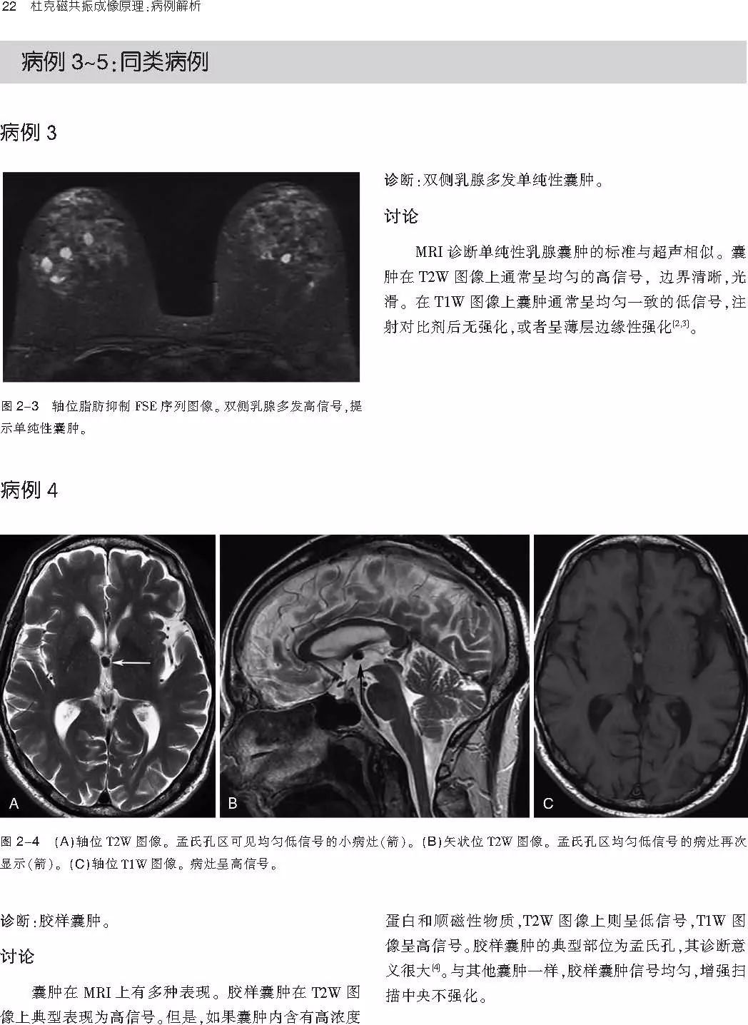 一睹芳容◆郁万江,主任医师,北京大学医学博士,青岛市市立医院