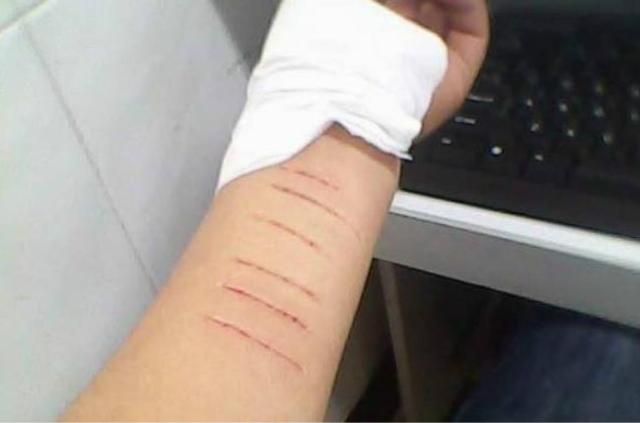 孩子生气就自残不会处理情绪表达怎么办家长应该重视