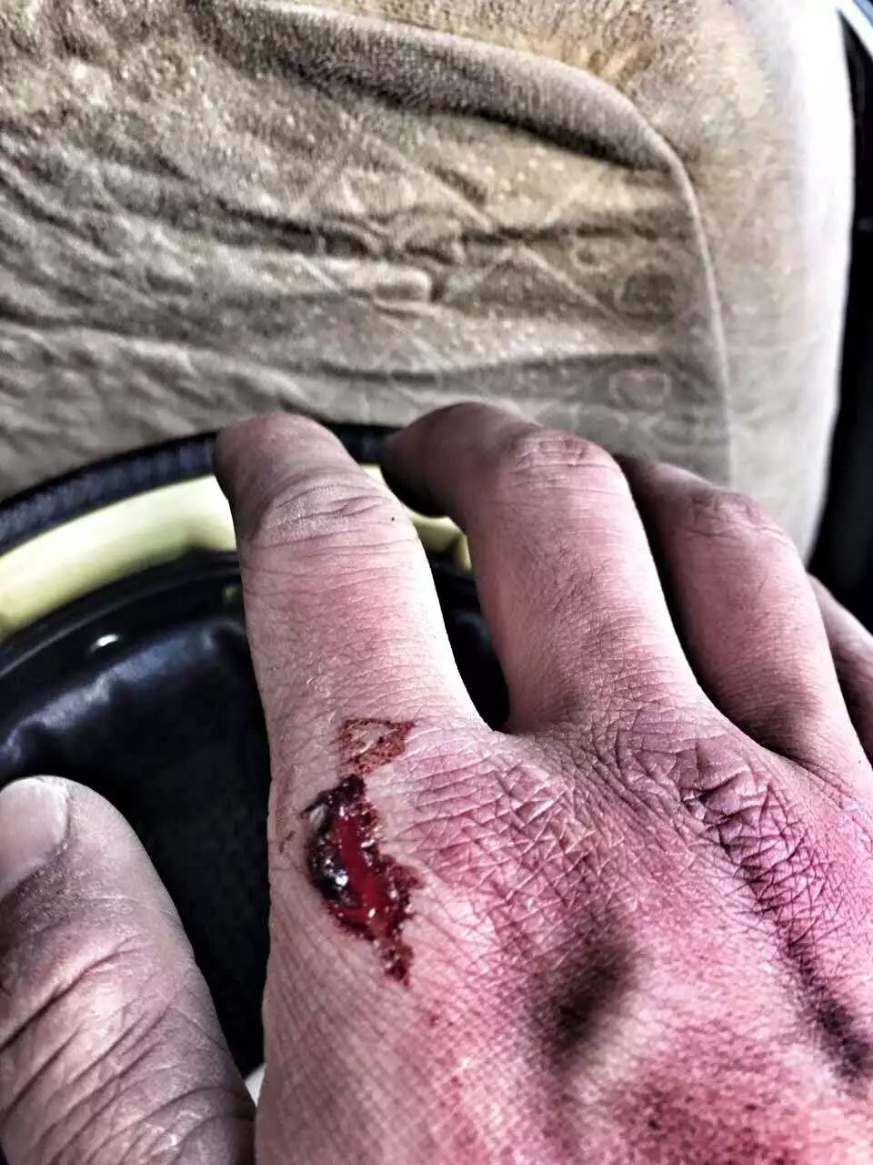 520因为热爱即使遍体鳞伤也风雨兼程