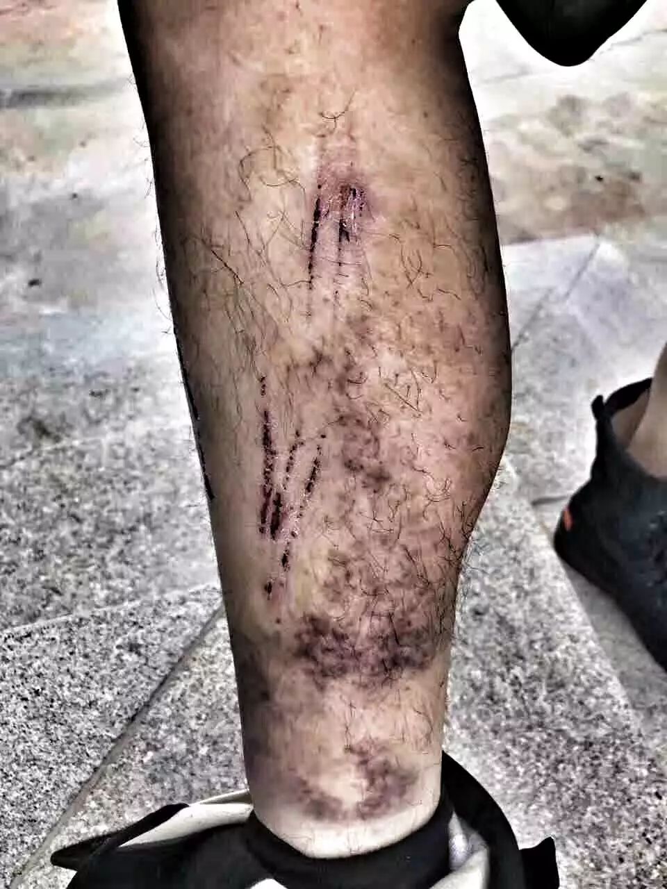 520因为热爱即使遍体鳞伤也风雨兼程