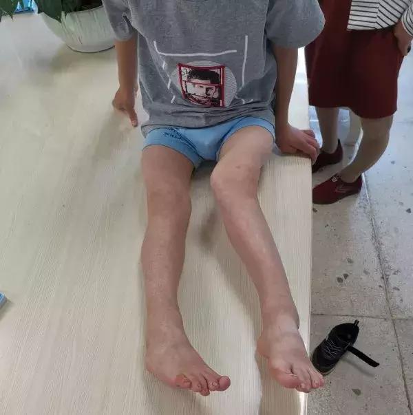 美女腿残娄底最美姐姐扛起怪病家族生活重担