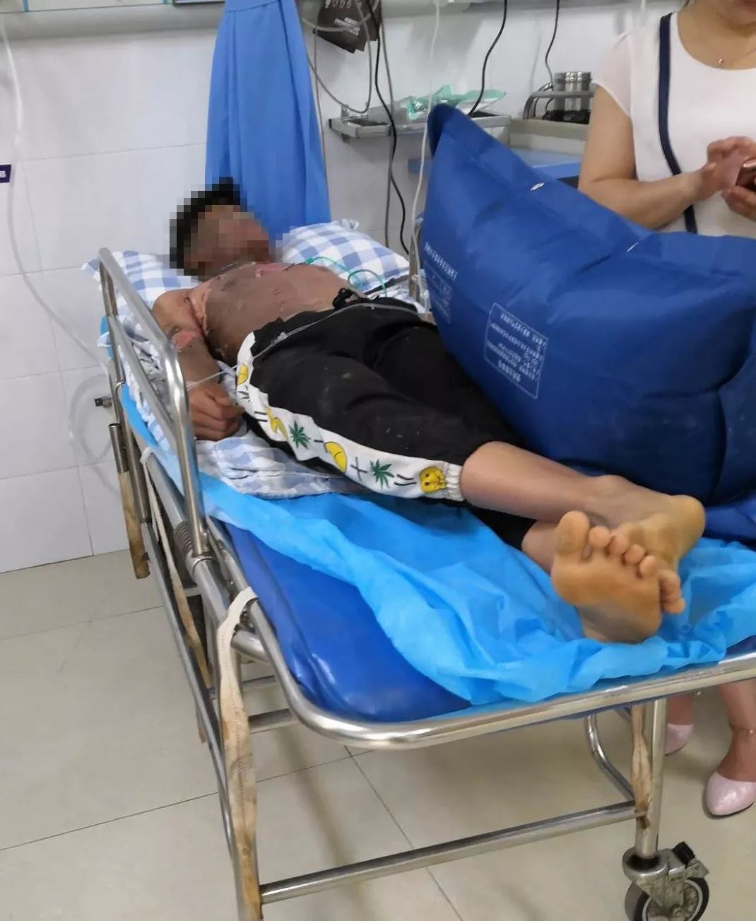 其中个高的那位被电击中不小心触碰到了高压线,据初步了解,是两名少年