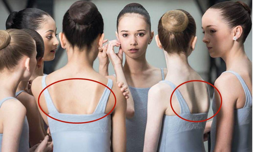 圆肩的自我测试和纠正方法